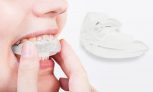 Appareil de contention orthodontique